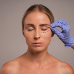 SMAS-лифтинг: всё, что нужно знать о глубокой подтяжке лица